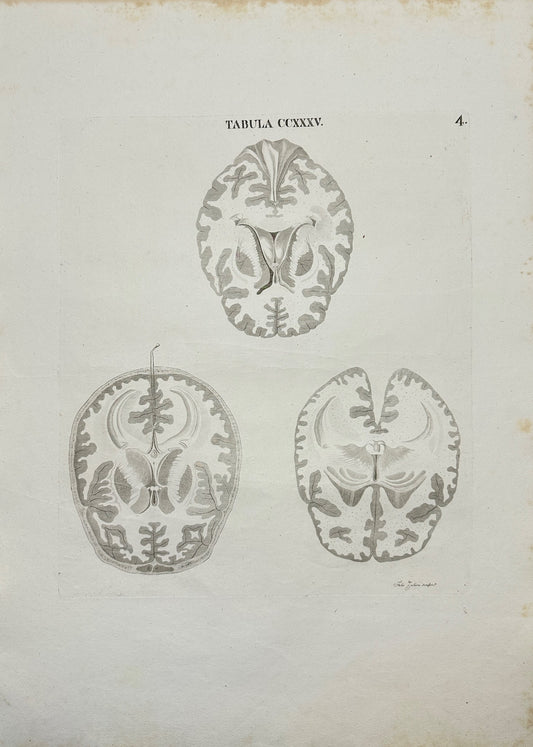 Original Antique Print - Caldani - Female Brain Sectioned Vertically - F4