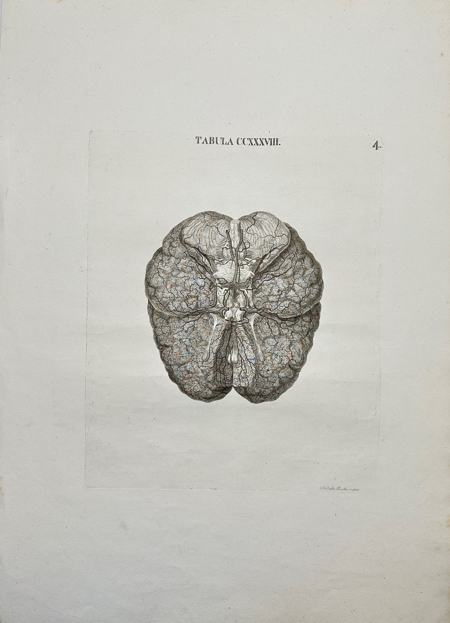 Anatomy Antique Print - Antonio Caldani - Arteries at the Base of the Brain - F4